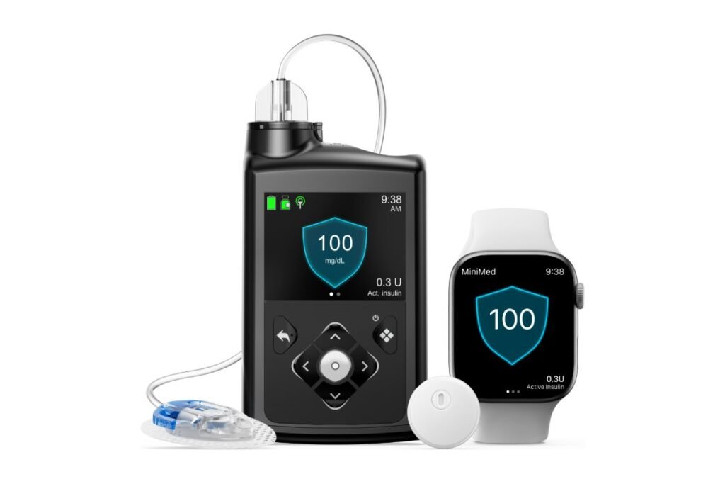 Sensor Instinct, pequeno e redondo, ao lado da bomba de insulina MiniMed 780G e de um relógio que mostra a glicose